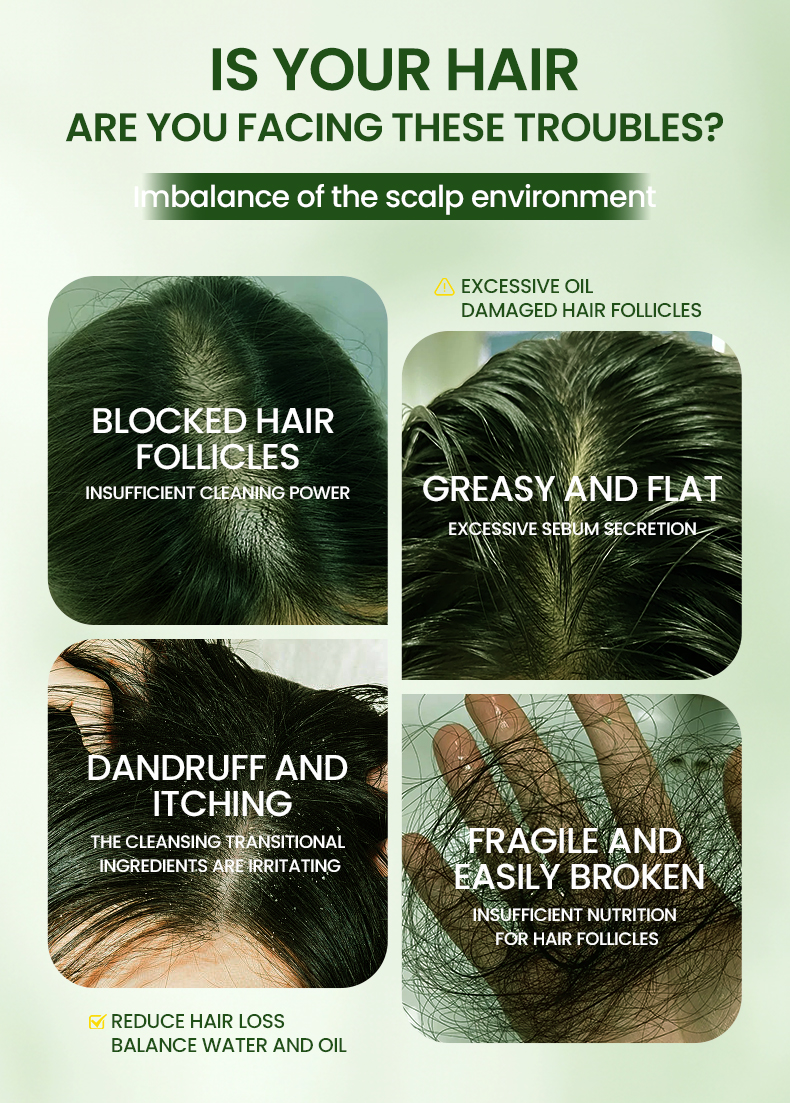 Customized Ushman Soap for Hair Growth Treatment | Natural & Organic Hair Care Soap(pic2)