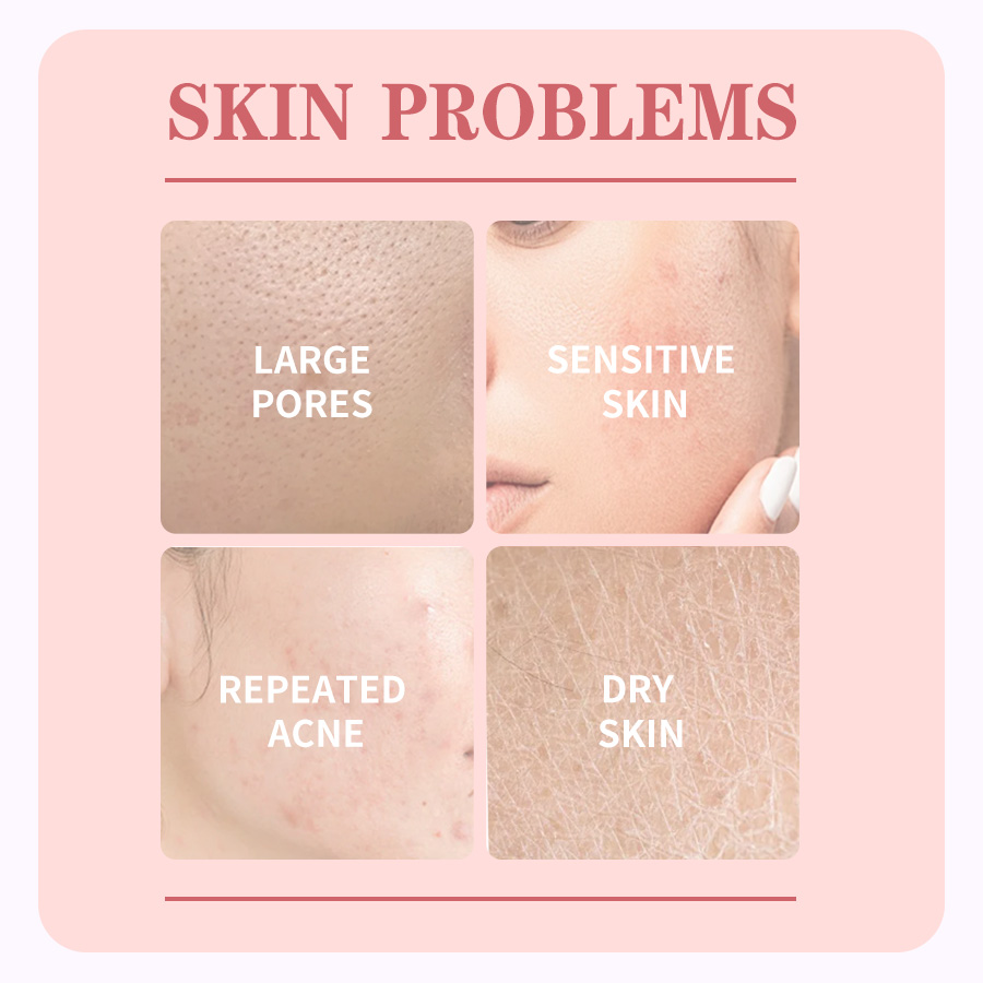 GreenLem Beauty Rose Facial Masque Peel Sheet Lightening Facial for Combination Skin Moisturizing Face(pic2)