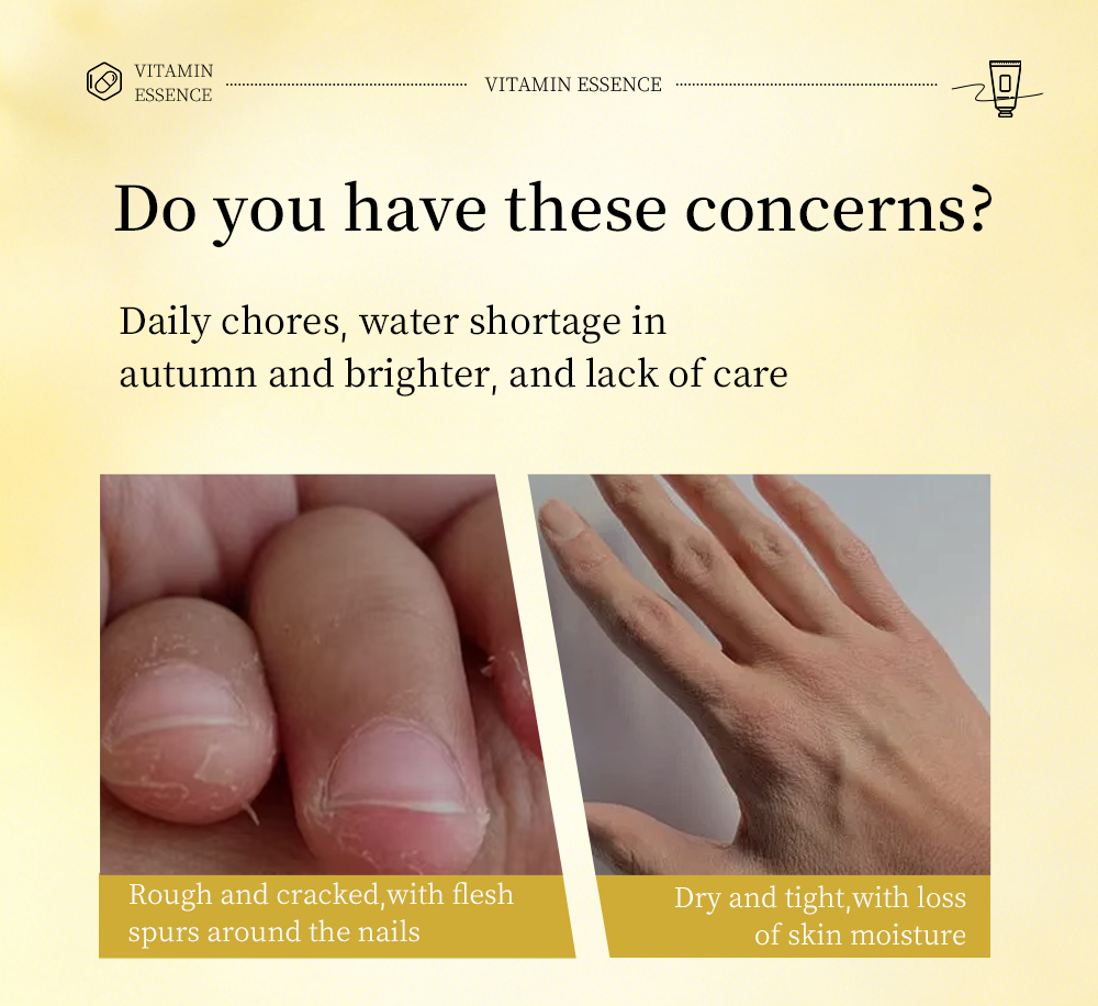 Icesea Vitamin-Enriched Hand & Nail Cream with Deep Moisturizing Essence for Dry Cracked Skin(pic2)