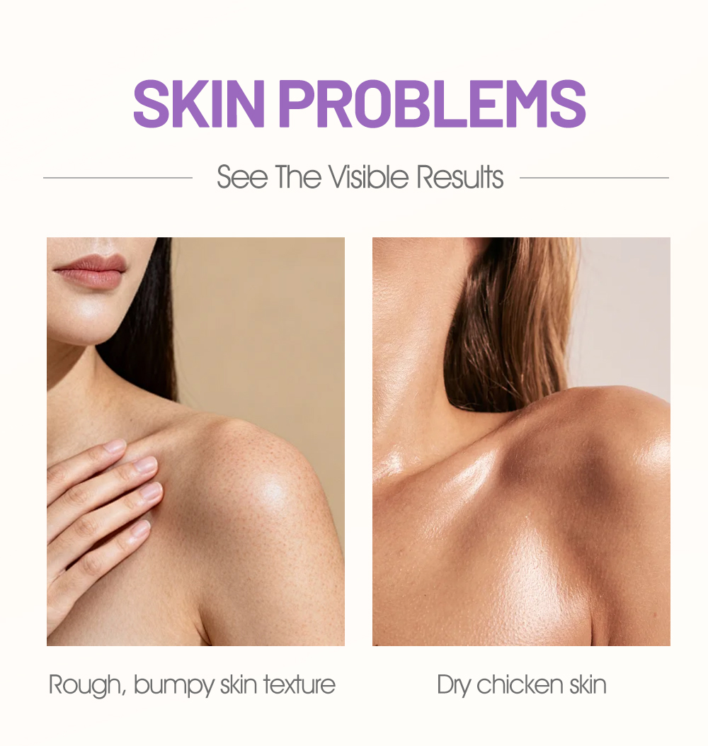 Chicken Skin Nourishing Cream with Vitamin E and Fresh Joy Fragrance for All Skin Types(pic2)