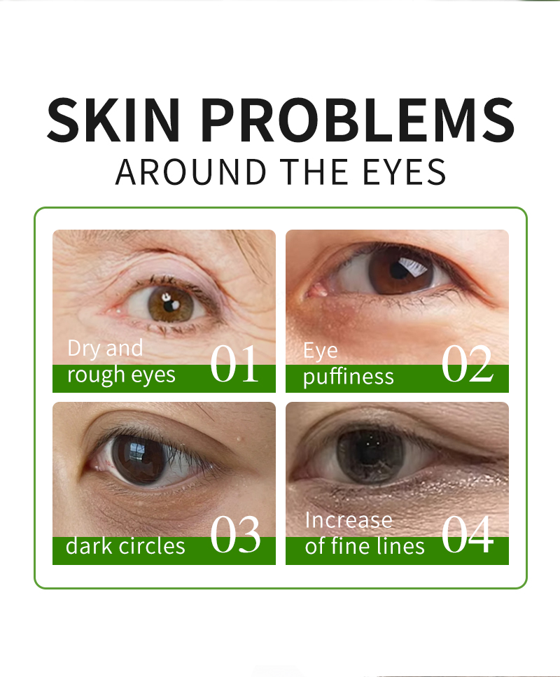 Private Label Anti-Wrinkle Eye Mask Caffeine & Hyaluronic Acid Revitalize Swollen Dark Circle Under Eye Mask OEM(pic2)