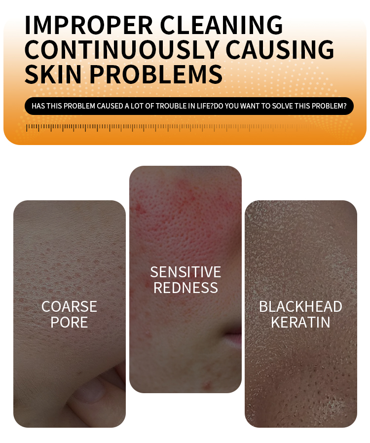 Natural Effective Kojic Acid Soap for Body Face Skin Brightening Exfoliating Bar Evens Skin Tone Fades Dark Spots Acne Marks(pic2)