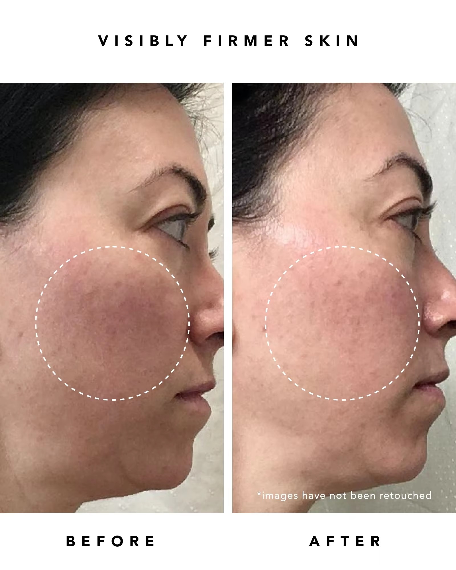 Private Label 30ML Dark Spot Remover Firming Skin Anti Wrinkles Anti Aging Moisturizing Retinol Serum(pic6)