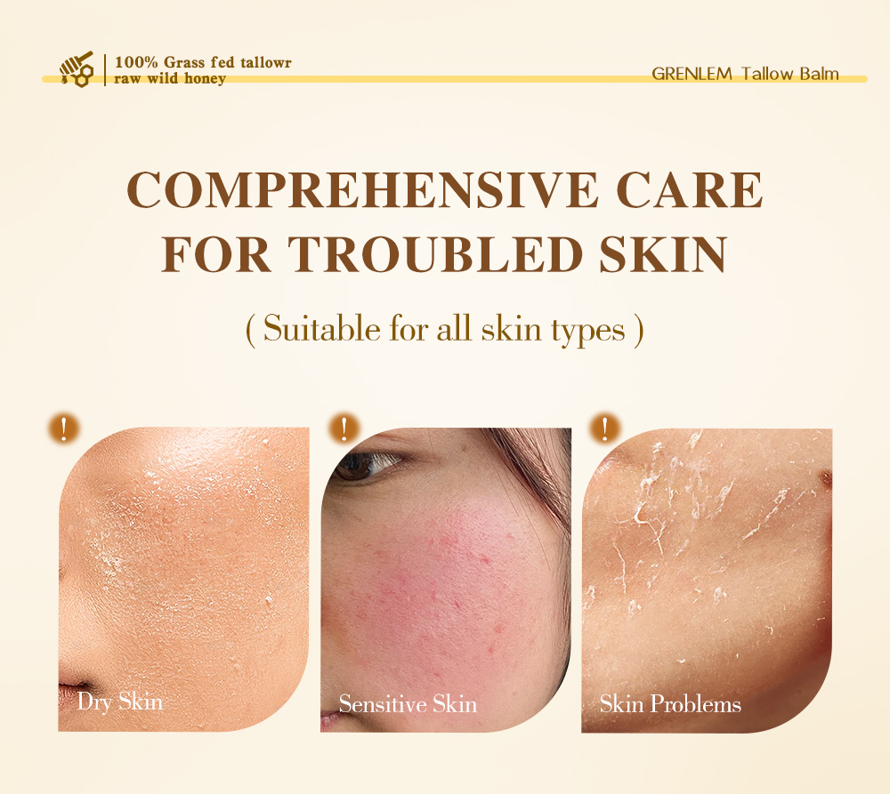 Greenlem TALLOW BALM Natural Beef Fat,Gently Nourishing(pic1) Greenlem TALLOW BALM Natural Beef Fat,Gently Nourishing(pic1)